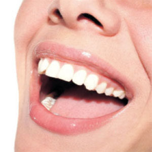 Examen dental gratuito